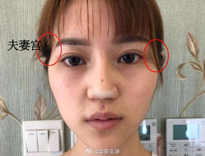 下眼窩深陷得女人面相