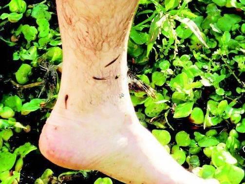 男人夢(mèng)見蛇咬了自己的手預(yù)示著什么