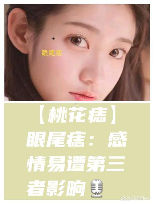 右眼有痣