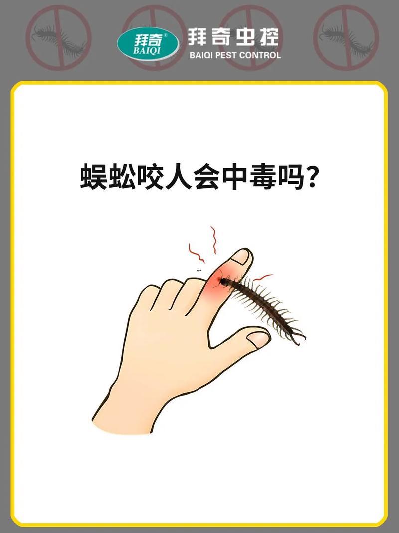 夢(mèng)見(jiàn)被蜈蚣咬手