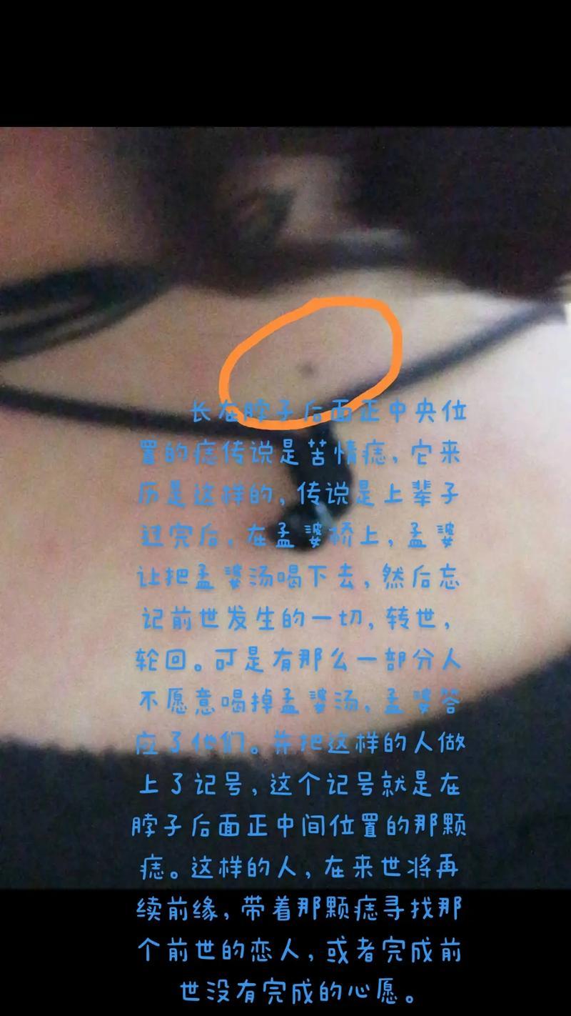 脖子后面的痣