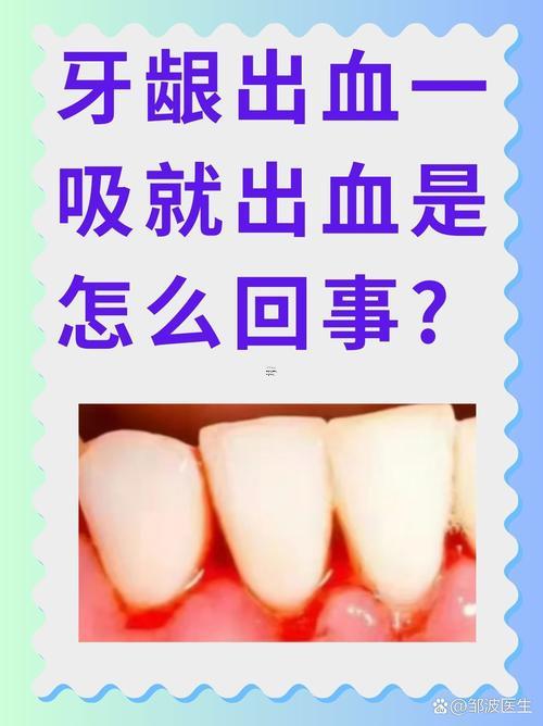 夢到掉牙齒許多血
